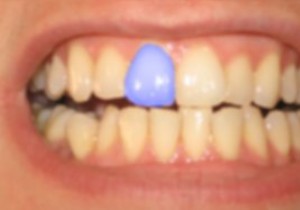 ब्लूटूथ सुरक्षा